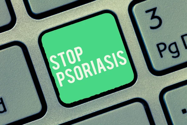 Signo de texto que muestra Stop Psoriasis. Foto conceptual Poner fin al trastorno que causa la rápida acumulación de células de la piel — Foto de Stock