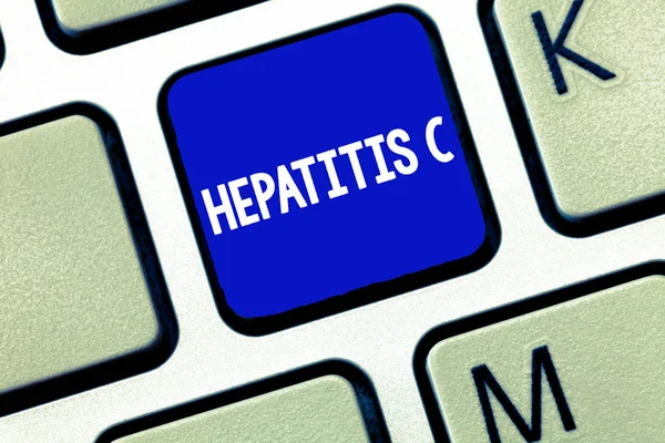 Text tecken visar hepatit C. konceptuella foto leverinflammation på grund av en virusinfektion lever sjukdom — Stockfoto