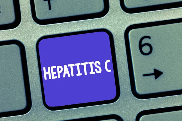 Ord skriva text hepatit C. affärsidé för Inflammation i levern på grund av en virusinfektion lever sjukdom — Stockfoto
