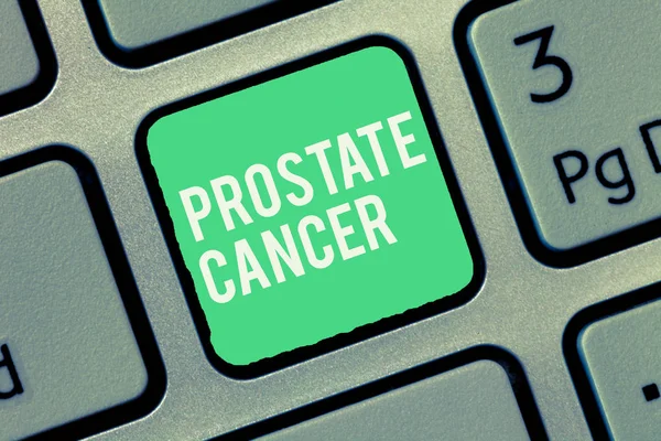 Text sign showing Prostate Cancer. Conceptual photo Cancer that occurs in the gland of male reproductive system — Stock Photo, Image