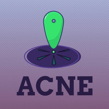 Word metin yazma akne. Yağ bezleri, saç köklerinin tabanına içeren deri hastalığı için iş kavramı