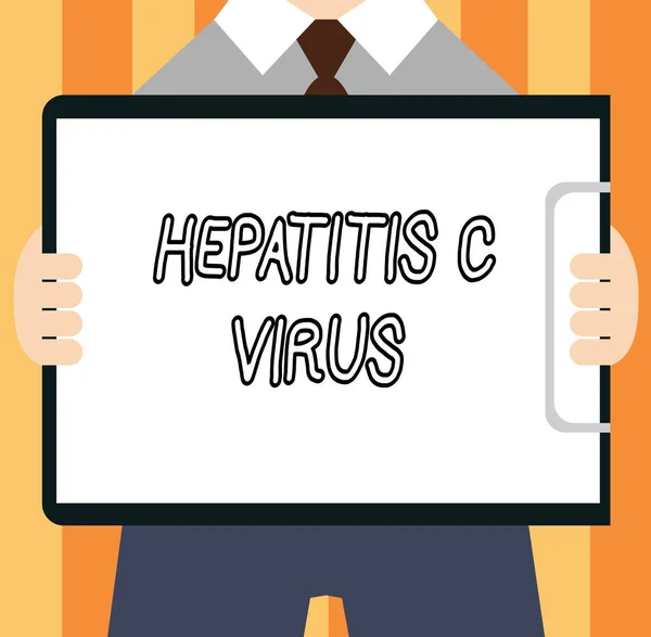 Word writing text Hepatitis c virus. Geschäftskonzept für Infektionserreger, die virale Hepatitis verursachen — Stockfoto