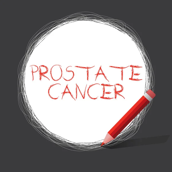 A escrever uma nota a mostrar o cancro da próstata. Foto de negócios mostrando Câncer que ocorre na glândula do sistema reprodutivo masculino — Fotografia de Stock