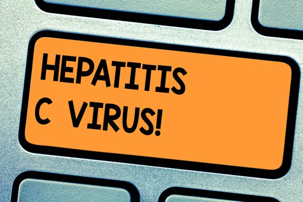 Ordet skriver text hepatitC-Virus. Affärsidé för vanligaste lägena av infektion tangent avsikt att skapa dator meddelande genom att trycka på knappsatsen idé och blodburna virus. — Stockfoto