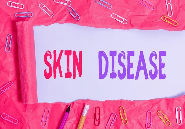 Text sign showing Skin Disease. Conceptual photo any of the diseases or disorders that affect the huanalysis skin.