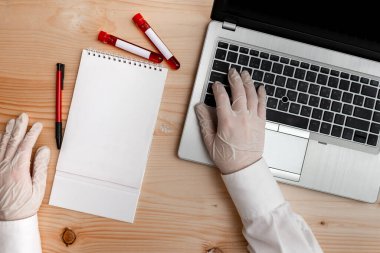 Çıkarılan insan kanının laboratuvar test tüpü modern aygıtlarla analiz ediliyor Sağlık Riski Teşhis Aracı için dizüstü bilgisayar