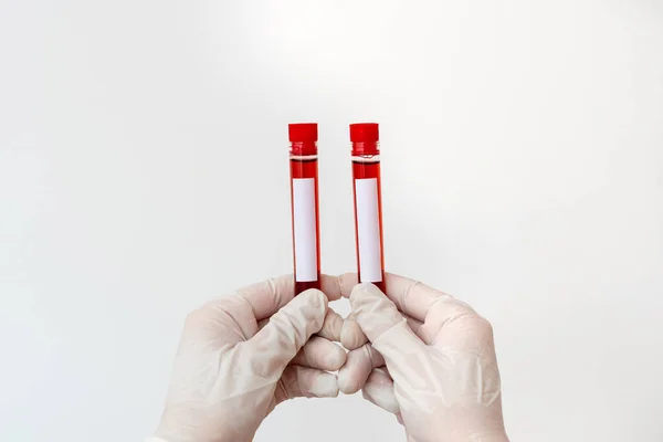 Técnico de laboratorio que sostiene el tubo de prueba de la muestra de sangre humana extraída para la herramienta de diagnóstico del riesgo de la salud. Concepto de análisis de investigación médica —  Fotos de Stock