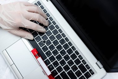 Çıkarılan insan kanının laboratuvar test tüpü modern aygıtlarla analiz ediliyor Sağlık Riski Teşhis Aracı için dizüstü bilgisayar