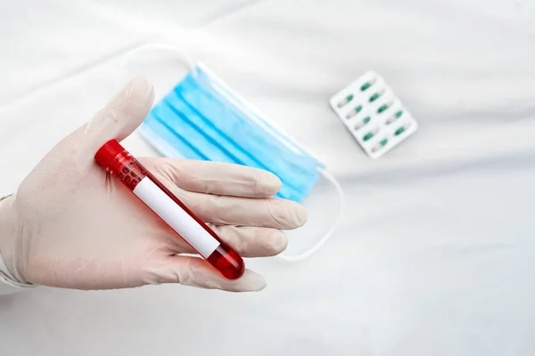 Εργαστηριακός τεχνικός που κατέχει σωλήνα δοκιμής του εκχυλισμένου δείγματος ανθρώπινου αίματος για το διαγνωστικό εργαλείο κινδύνου υγείας. Ιατρική Ανάλυση Έννοια Έρευνας — Φωτογραφία Αρχείου