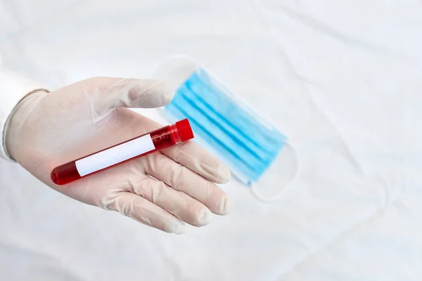 Técnico de laboratorio que sostiene el tubo de prueba de la muestra de sangre humana extraída para la herramienta de diagnóstico del riesgo de la salud. Concepto de análisis de investigación médica —  Fotos de Stock