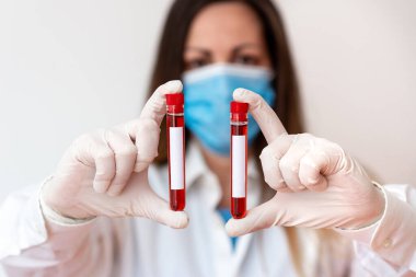 Laboratuvar Deneyi için Tıbbi Cübbe Eldiveni Giyen Adam. Sağlık Durumu Analizi İçin Kan Test Tüpü Tutuluyor