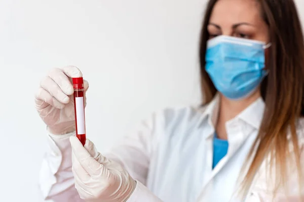 Persona que usa guantes médicos del vestido para realizar el experimento del laboratorio. Detener el tubo de prueba de sangre para el análisis de la condición de salud —  Fotos de Stock