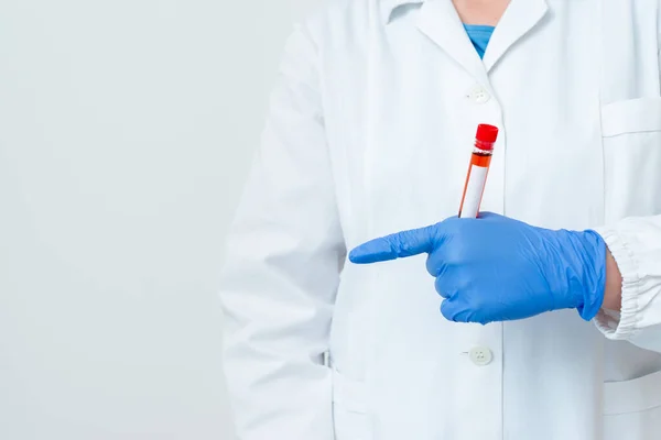 Persona que usa guantes médicos del vestido para realizar el experimento del laboratorio. Detener el tubo de prueba de sangre para el análisis de la condición de salud —  Fotos de Stock
