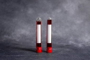Laboratuvar test tüplerinde çıkarılan insan kanı örneklerini göster. Düzenlenmiş Tıbbi Aksesuarlar ve Biyoteknoloji Konsepti