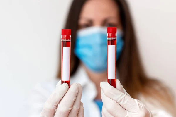 Πρόσωπο που φορά ιατρικά γάντια φόρεμα για την εκτέλεση εργαστηριακό πείραμα. Συγκράτηση σωλήνα δοκιμής του αίματος για την ανάλυση της κατάστασης της υγείας — Φωτογραφία Αρχείου
