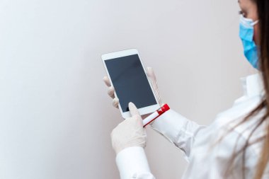 Çıkarılan insan kanının laboratuvar test tüpü modern aygıtlarla analiz ediliyor Sağlık Riski Teşhis Aracı için dizüstü bilgisayar