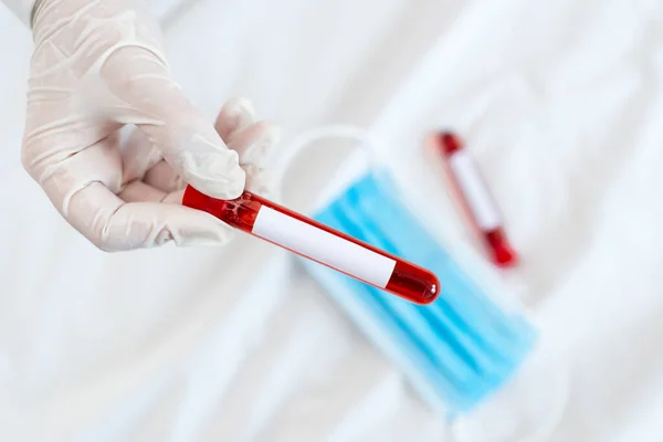 Лабораторний технік проводить випробувальну трубку витягнутої крові людини для діагностичного інструменту для діагностики ризику для здоров'я. Концепція медичних досліджень — стокове фото