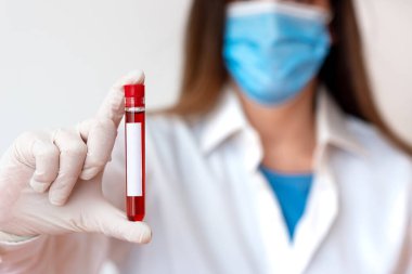 Laboratuvar Deneyi için Tıbbi Cübbe Eldiveni Giyen Adam. Sağlık Durumu Analizi İçin Kan Test Tüpü Tutuluyor