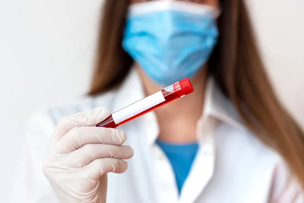 Persona que usa guantes médicos del vestido para realizar el experimento del laboratorio. Detener el tubo de prueba de sangre para el análisis de la condición de salud —  Fotos de Stock