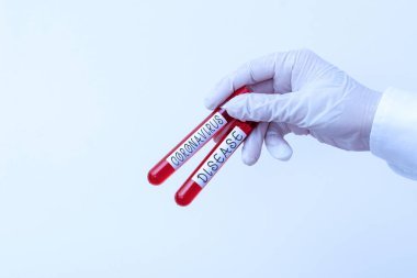 Kelime yazma Coronavirus Hastalığı. Yeni bir virüs olan SARSCoV2 'nin yol açtığı hastalık olarak tanımlanan iş konsepti çıkartılan kan örneği şişesi tıbbi tanı incelemesi için hazır..