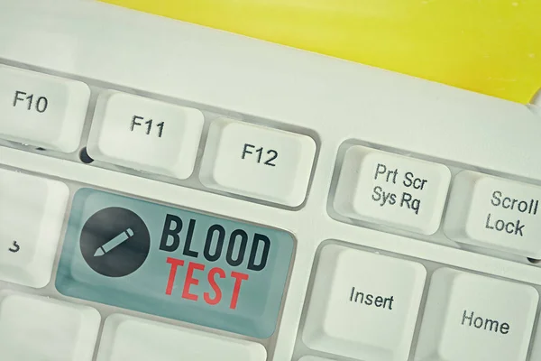 Az SMS-ben vérvizsgálat van. Fogalmi fotó Kivont vérminta egy szervezetből, hogy tökéletesítse a laboratóriumi elemzés White pc billentyűzet üres jegyzet papír felett fehér kulcs másolási hely. — Stock Fotó