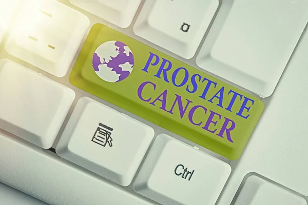 Word writing text Prostate Cancer. Business concept for development of cancer in the male reproductive system White pc keyboard with empty note paper above white key copy space. — Stock Photo, Image