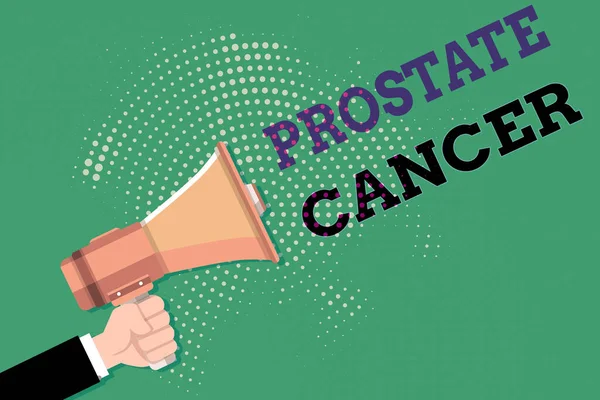 Text sign showing Prostate Cancer. Conceptual photo development of cancer in the male reproductive system Male Hu analysis Hand Holding Gripping a Megaphone on Dotted Halftone Pattern. — Stock Photo, Image