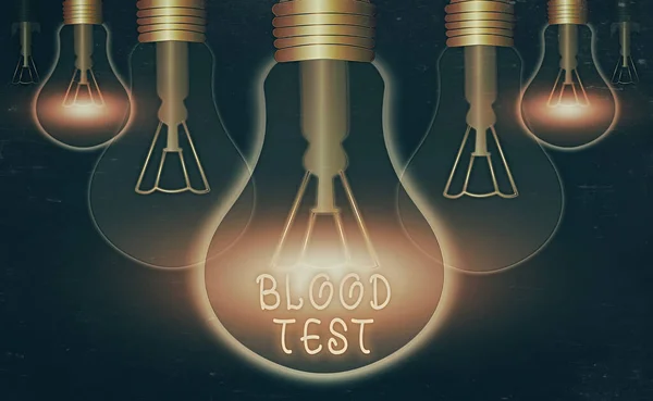 Text sign showing Blood Test. Conceptual photo Extracted blood sample from an organism to perfom a laboratory analysis Realistic colored vintage light bulbs, idea sign solution thinking concept. — Stock Photo, Image