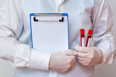 Laboratuvar Deneyi için Tıbbi Cübbe Eldiveni Giyen Adam. Sağlık Durumu Analizi İçin Kan Test Tüpü Tutuluyor