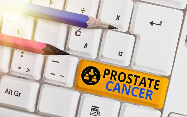 Conceptual hand writing showing Prostate Cancer. Business photo text development of cancer in the male reproductive system Colored keyboard key with accessories arranged on empty copy space. — Stock Photo, Image