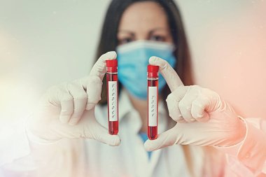 Viroloji 'yi gösteren mesaj işareti. Bilimin kavramsal fotoğraf dalı, tıbbi tanı analizi sonucu için gösterilen viral etkenler ve hastalık laboratuvarı kan testi örnekleriyle ilgilenir..