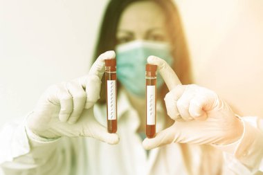 Düzelmeleri gösteren mesaj işareti. Tıbbi tanı analizi sonucu için gösterilen kayıp bir laboratuvar kan testi örneğinin ele geçirilmesi ya da kontrolü kavramsal fotoğraf süreci.