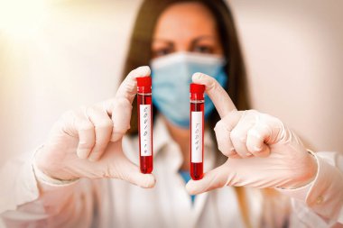 Mesaj işareti Covid19 'u gösteriyor. Tıbbi teşhis analizi için gösterilen Coronavirus Laboratuvarı kan testi örneğinden kaynaklanan hafif ya da ağır solunum rahatsızlığı olan kavramsal fotoğraf..
