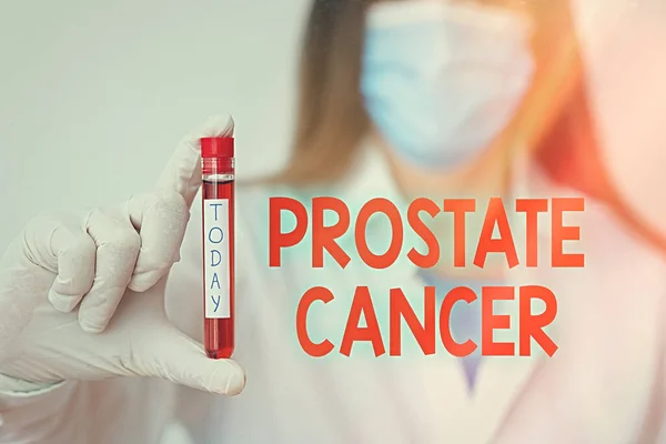 Handwriting text writing Prostate Cancer. Concept meaning development of cancer in the male reproductive system Laboratory blood test sample shown for medical diagnostic analysis result. — Stock Photo, Image