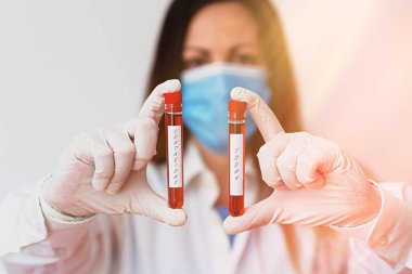 Mesajda bulaşıcı olduğu yazıyor. Tıbbi tanı analizi sonucu için gösterilen bireysel bir laboratuvar kan testi örneğiyle doğrudan veya dolaylı temasla iletilebilir kavramsal fotoğraf.