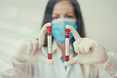 Mesaj pandemik olduğunu gösteriyor. Geniş bir alanda meydana gelen kavramsal fotoğraf tıbbi tanı analizi sonucu için gösterilen kan testi örneğinin nüfusun yüksek oranını etkiliyor..