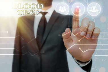 Kan Testi 'ni gösteren not yazıyorum. Bir organizmadan alınan kan örneğini laboratuvar analiz sistemi denetimi, dişli yapılandırma araçları için mükemmelleştirmek için iş fotoğrafı gösterimi