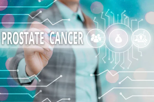 Word writing text Prostate Cancer. Business concept for development of cancer in the male reproductive system System administrator control, gear configuration settings tools concept. — Stock Photo, Image