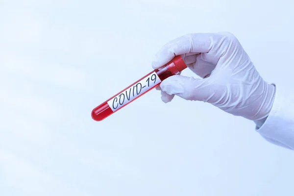 Writing note showing Covid19. Business photo showcasing mild to severe respiratory illness that is caused by a coronavirus Extracted blood sample vial ready for medical diagnostic examination . — Stock Photo, Image