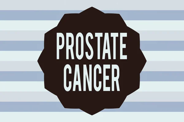 Signe texte montrant Cancer de la prostate. Développement conceptuel de la photo du cancer dans le système reproducteur masculin Douze 12 Pointu forme d'étoile Dodécagone en couleur unie effet Zigzag Polygone. — Photo