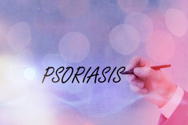 Text sign showing Psoriasis. Conceptual photo chronic skin disease characterized by patches with white scales Graphics padlock for web data information security application system. clipart
