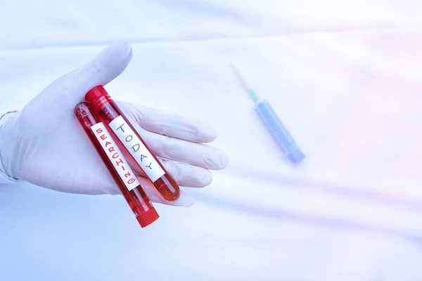 Escritura a mano Búsqueda de texto. Concepto que significa examinar o revisar cuidadosamente o a fondo en un esfuerzo por encontrar un vial de muestra de sangre extraída listo para un examen de diagnóstico médico . —  Fotos de Stock