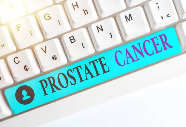 Writing note showing Prostate Cancer. Business photo showcasing development of cancer in the male reproductive system Colored keyboard key with accessories arranged on empty copy space. — Stock Photo, Image