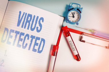 Virüs Tespit Edildiğini gösteren not yazılıyor. Kötü amaçlı kan örneği şişesi tıbbi aksesuarlarını incelemeye hazır hale getirmek için kullanılan bir bilgisayar programını gösteren iş fotoğrafı.