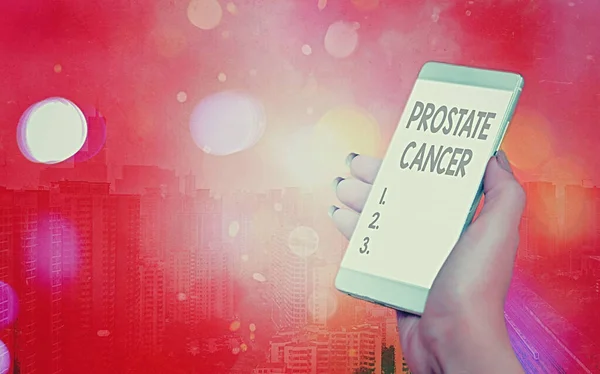 Word writing text Prostate Cancer. Business concept for development of cancer in the male reproductive system Modern gadgets with white display screen under colorful bokeh background.