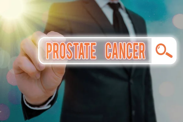 Writing note showing Prostate Cancer. Business photo showcasing development of cancer in the male reproductive system Web search digital information futuristic technology network connection. — Stock Photo, Image