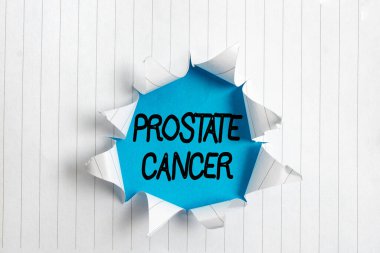 Prostat kanserini gösteren bir not yazıyorum. Erkek üreme sisteminde kanserin gelişimini gösteren iş fotoğrafı ahşap klasik bir masanın üzerinde yuvarlanmış yırtık bir karton..