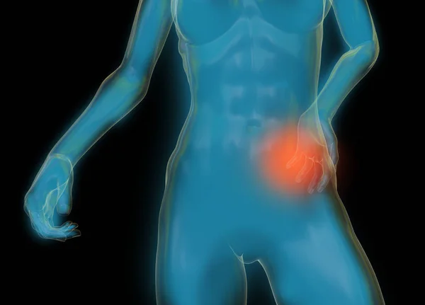 Weiblicher Frauentorso aus Glas oder Blase, Rückenschmerzen isoliert auf schwarzem Hintergrund. 3D gerenderte medizinische Illustration — Stockfoto
