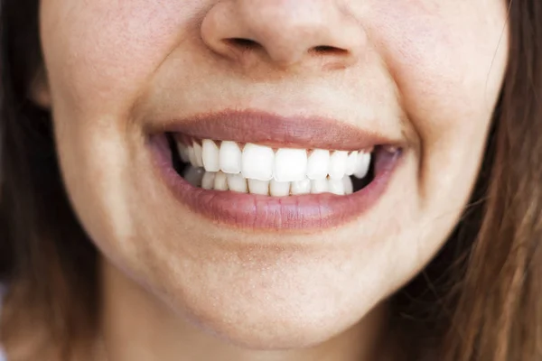 Close up of smile with white healthy teeth