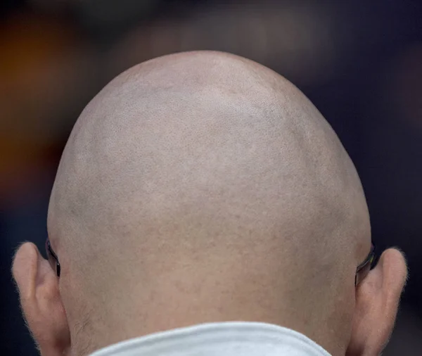 bald man's head